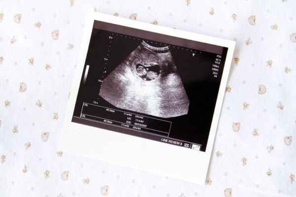Δεν ήξερα ότι είμαι έγκυος! Μήπως δεν έπρεπε να… | imommy.gr