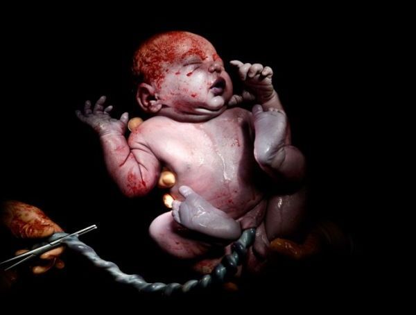 Εκπληκτικές φωτογραφίες νεογέννητων μωρών τα πρώτα δευτερόλεπτα της ζωής τους | imommy.gr