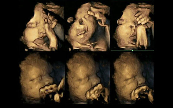 Οι σοκαριστικές εικόνες του εμβρύου όταν η μαμά του καπνίζει! | imommy.gr