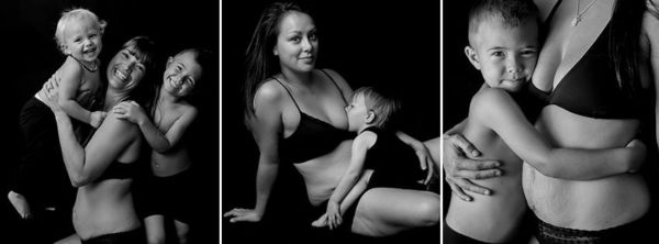 «Honest Body Project»: Η αληθινή εικόνα της μητρότητας | imommy.gr