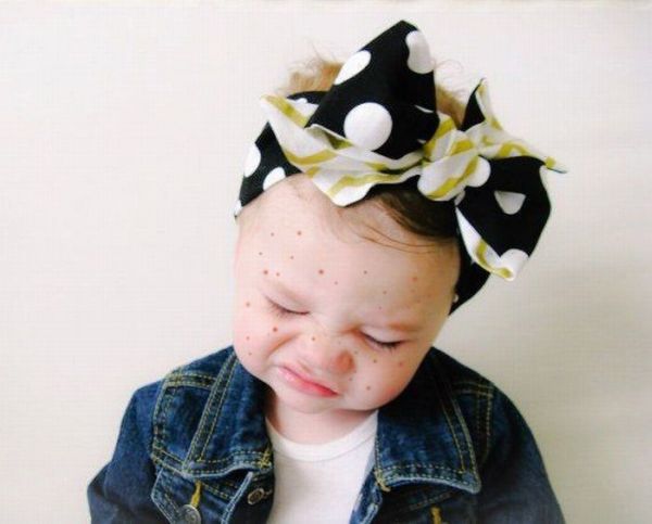 Έβγαλε εξάνθημα; Αντιμετωπίστε το! | imommy.gr