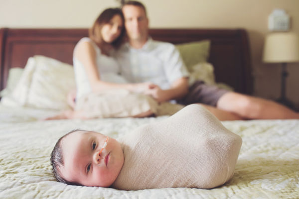 Εικόνες: Η συγκινητική φωτογράφιση ενός νεογέννητου με όγκο στον εγκέφαλο | imommy.gr