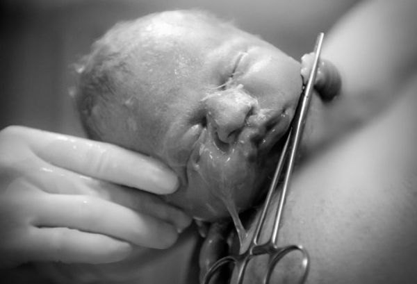 Εικόνες: Η μοναδική στιγμή της γέννας που βγαίνει το κεφαλάκι του μωρού | imommy.gr