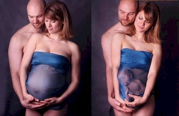 Αυτές είναι οι 22 πιο αποτυχημένες και κιτς φωτογραφίες εγκυμοσύνης που έχετε δει!!! | imommy.gr