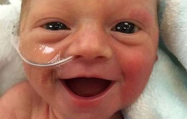 Πρόωρο μωρό μόλις 1.700 γραμμαρίων, χαμογελάει στην αγκαλιά της μαμάς του..(εικόνες) | imommy.gr