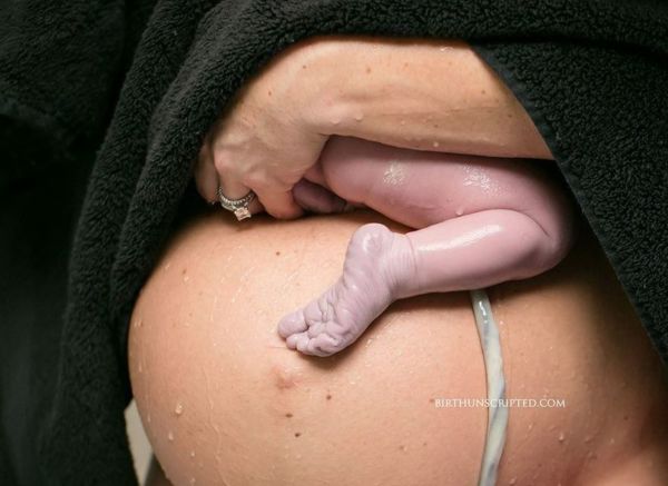 Οι καλύτερες φωτογραφίες τοκετού για το 2017 | imommy.gr