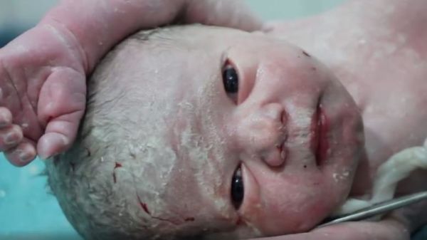 Συγκλονιστικό βίντεο: Γέννα εν μέσω βομβαρδισμών | imommy.gr