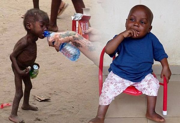 Ο Hope, το σκελετωμένο παιδί από την Νιγηρία ξεκίνησε το σχολείο. | imommy.gr