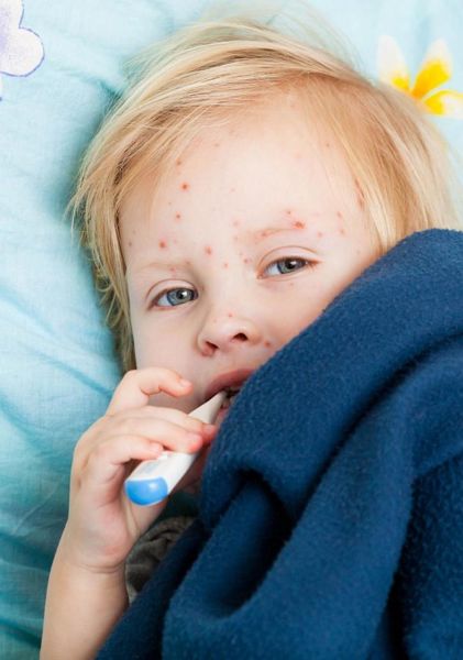 Ιλαρά: Όλα όσα πρέπει να γνωρίζετε σε 8 ερωτήσεις! | imommy.gr