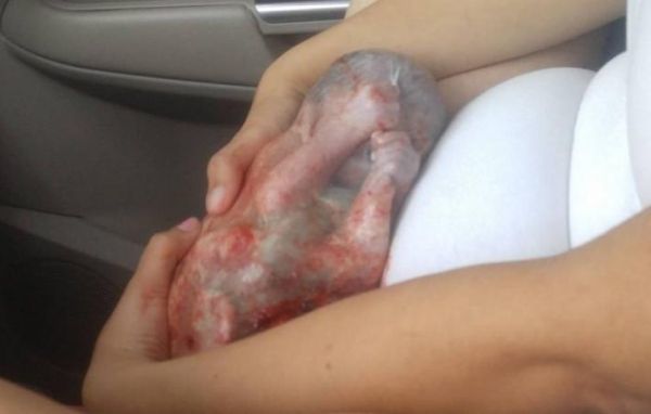 Γέννησε μέσα στο αμάξι, με το μωρό ακόμα μέσα στον αμνιακό σάκο!!! | imommy.gr