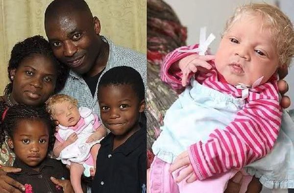 Μαύροι γονείς έφεραν στον κόσμο λευκό μωράκι! | imommy.gr