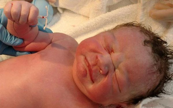 Το μωρό «μαχητής» που γεννήθηκε αψηφώντας την αντισύλληψη | imommy.gr
