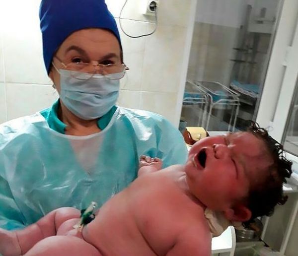 Μαμά γεννάει μωρό που ζυγίζει 6,3 κιλά, δίχως επισκληρίδιο! | imommy.gr