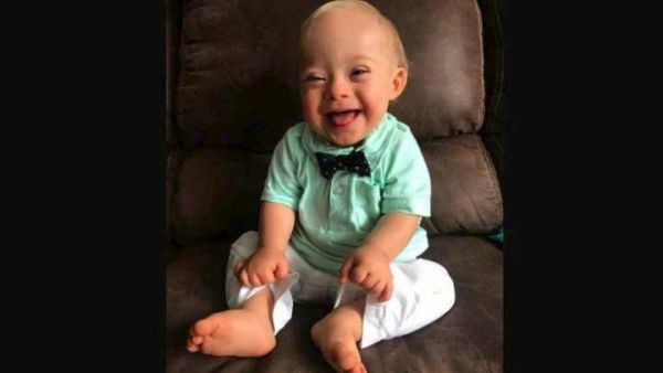 Αυτός είναι ο Λούκας: Το πρώτο μωρό με σύνδρομο Down στην ιστορία της Gerber | imommy.gr