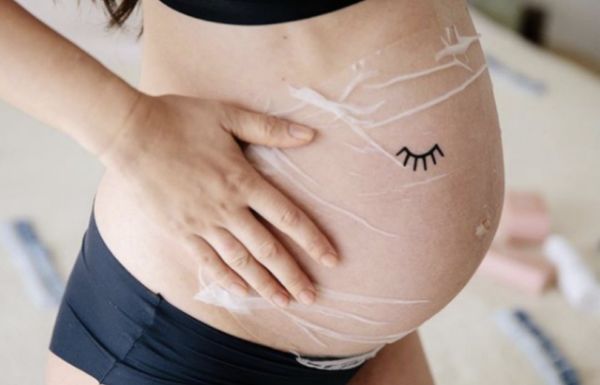 Μάσκα για την κοιλιά της εγκυμοσύνης ενάντια στις ραγάδες | imommy.gr
