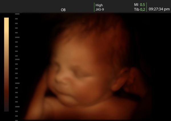 Βίντεο: Τώρα και οι μπαμπάδες μπορούν να νιώσουν το έμβρυο! | imommy.gr