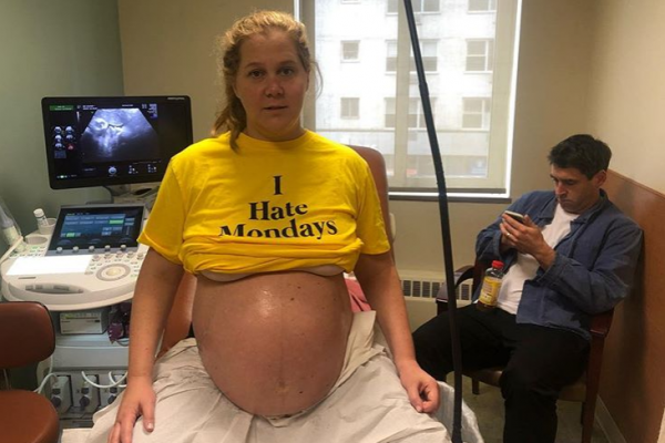 Η Έιμι Σούμερ γέννησε το δικό της «βασιλικό” μωρό | imommy.gr