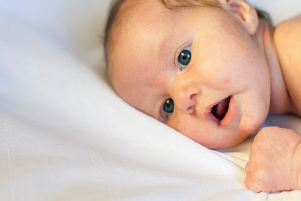 Ακμή στα μωρά: Τι είναι και πώς θα την αντιμετωπίσετε | imommy.gr