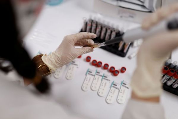 Κοροναϊός: Τι δείχνουν οι κλινικές μελέτες για τη θεραπεία με Remdesivir | imommy.gr