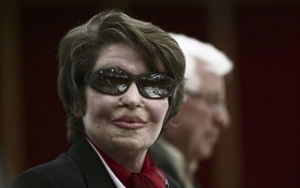 Οι επιθέσεις με βιτριόλι που έχουν συγκλονίσει: Από την Κούνεβα στην… Σωτηρία Μπέλλου | imommy.gr