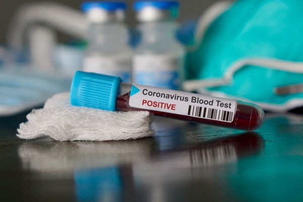 Κοροναϊός: Μια απλή εξέταση αίματος αποκαλύπτει πόσο κινδυνεύει ο ασθενής | imommy.gr