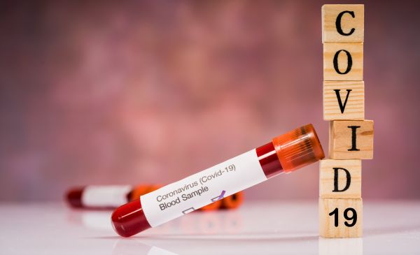 Οι άνθρωποι με αυτή την ομάδα αίματος έχουν μειωμένες πιθανότητες να μολυνθούν από κοροναϊό | imommy.gr