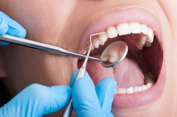 Πώς επηρεάζει την υγεία των δοντιών ο κοροναϊός | imommy.gr