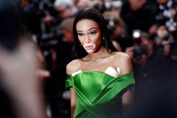 Η Winnie Harlow αποχωρίστηκε τα μακριά της μαλλιά για ένα τολμηρό pixie cut | imommy.gr