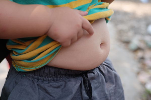 Μελέτη – Αυξήθηκε η παιδική παχυσαρκία κατά τη διάρκεια της πανδημίας | imommy.gr